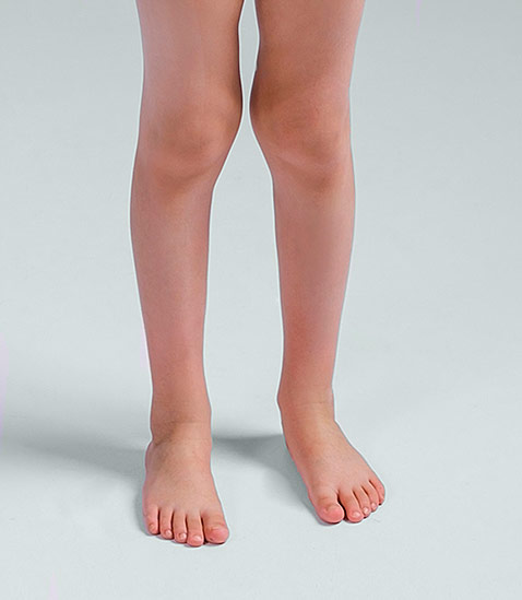 Асимметрия ног: симптомы, причины и лечение